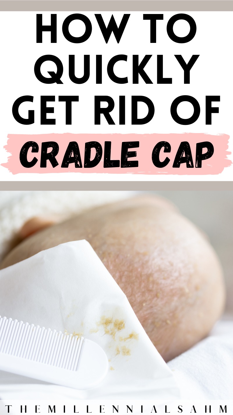 Cradle Cap is a very common skin rash that occurs in infants and this cradle cap treatment will help you clear it up fast.
