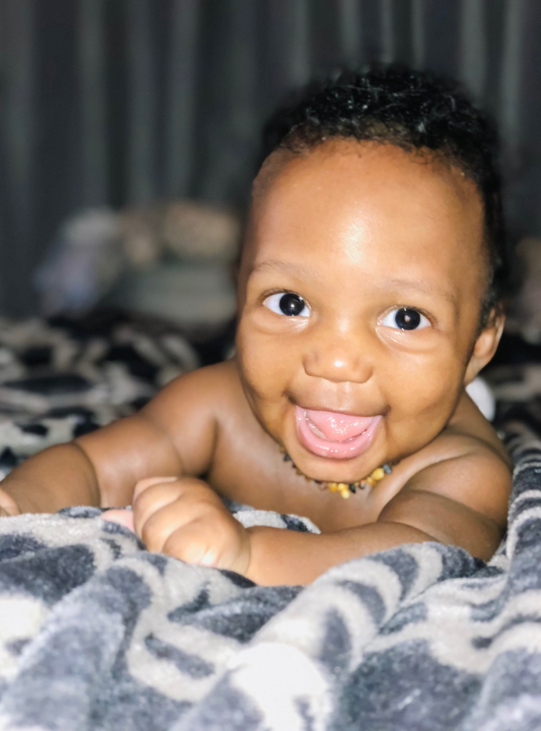 Cradle Cap : How To Treat It Fast